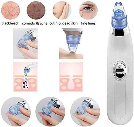 DermaSuction Blackhead & Dirt Remover